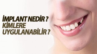 İmplant nedir ? Kimlere Uygulanabilir ?