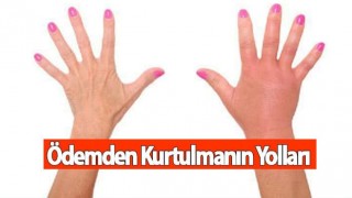 Ödemden Kurtulmanın Yolları