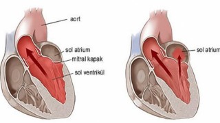 Kalbin içindeki mucize: Mitral kapak