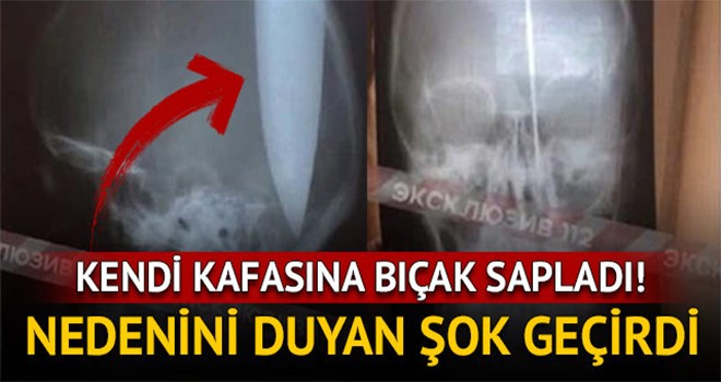 Nefes almak için kafasını deldi